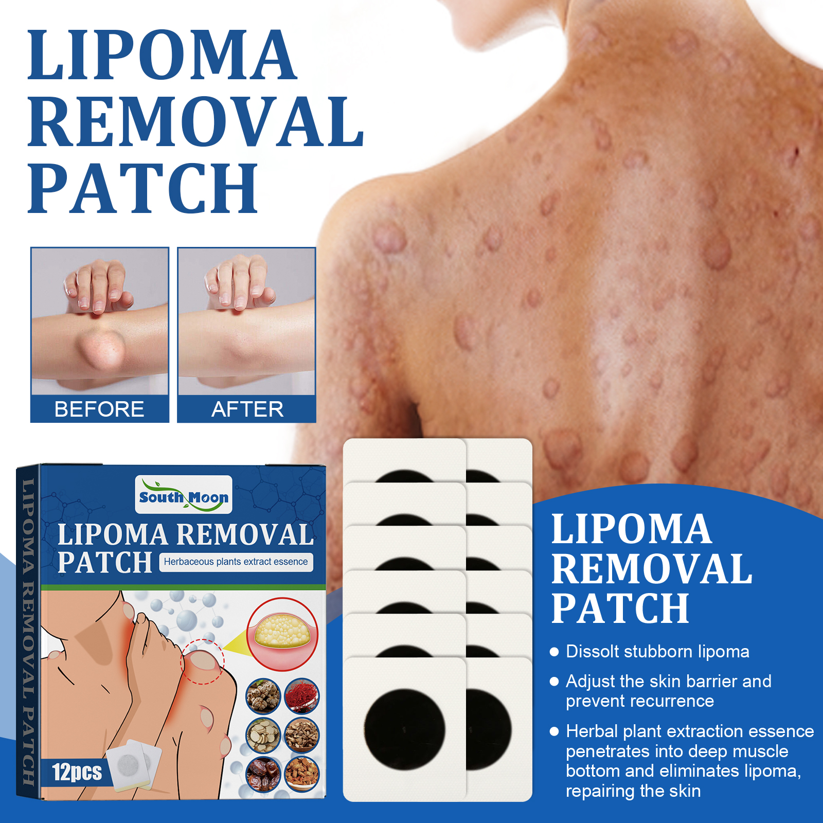 Lipoma Removal Patch, Soothing Various Body Fat Knots To Rem