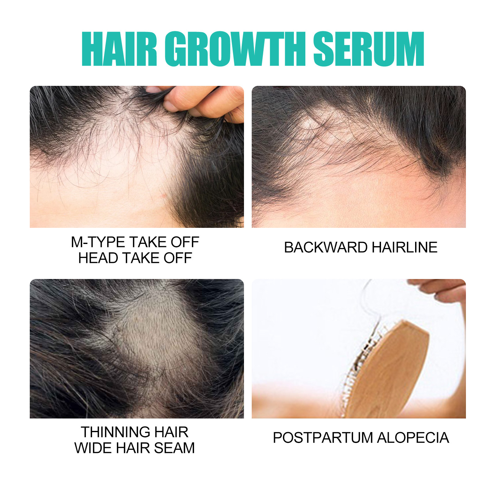 Hairline thinning and postpartum care reference images