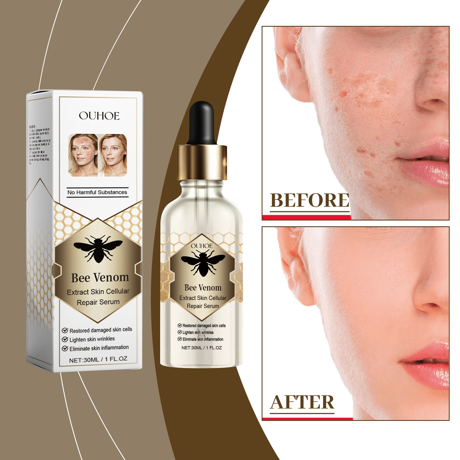 Bee venom serum displayed beside complexion comparison images
