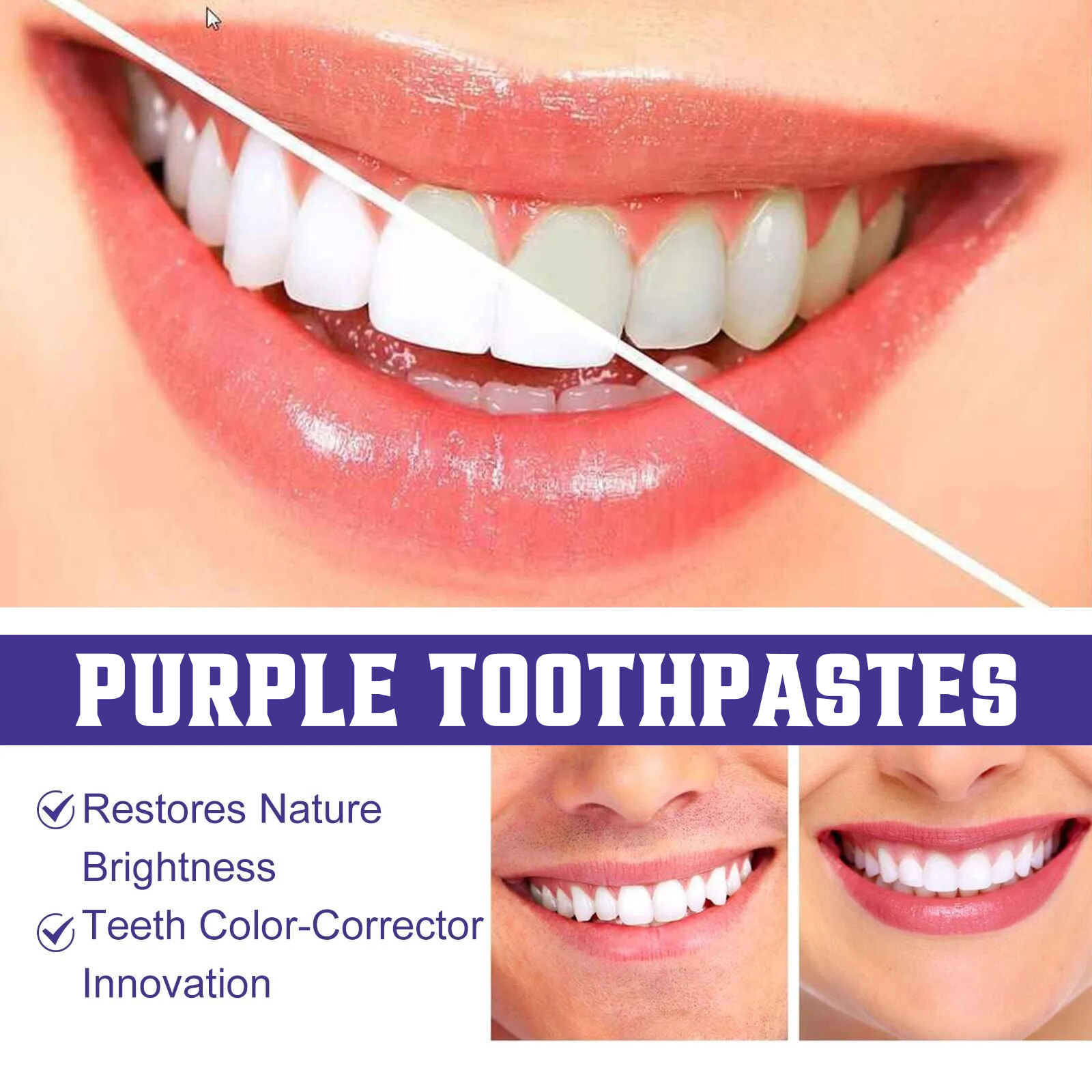 Teeth comparison showing dull and brighter-looking smiles
