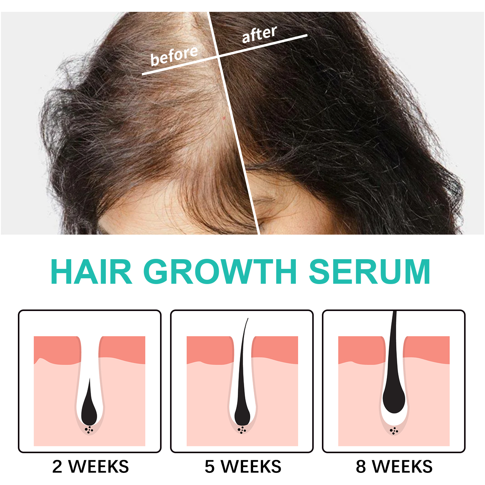 Hair density imagery beside serum progression graphic