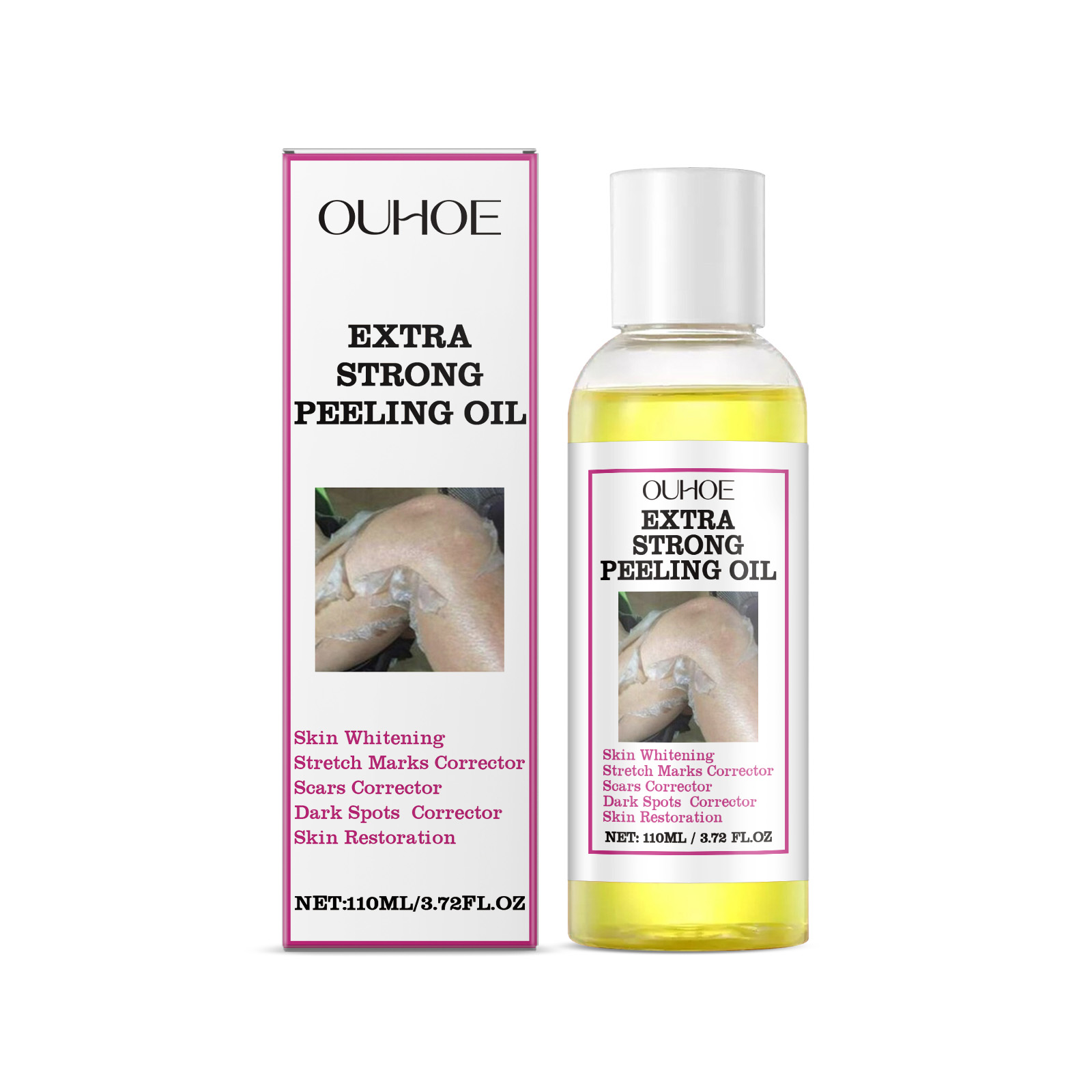 OUHOE Exfoliating Yellow Skin Oil Body Skin Moisturizing, Brightening, Firming And Hydrating Massage