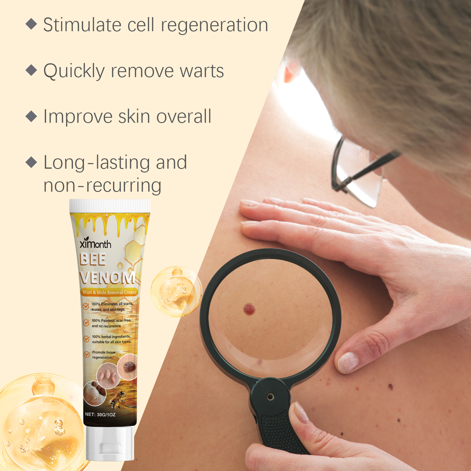 Cream tube beside magnifying glass and skin spot