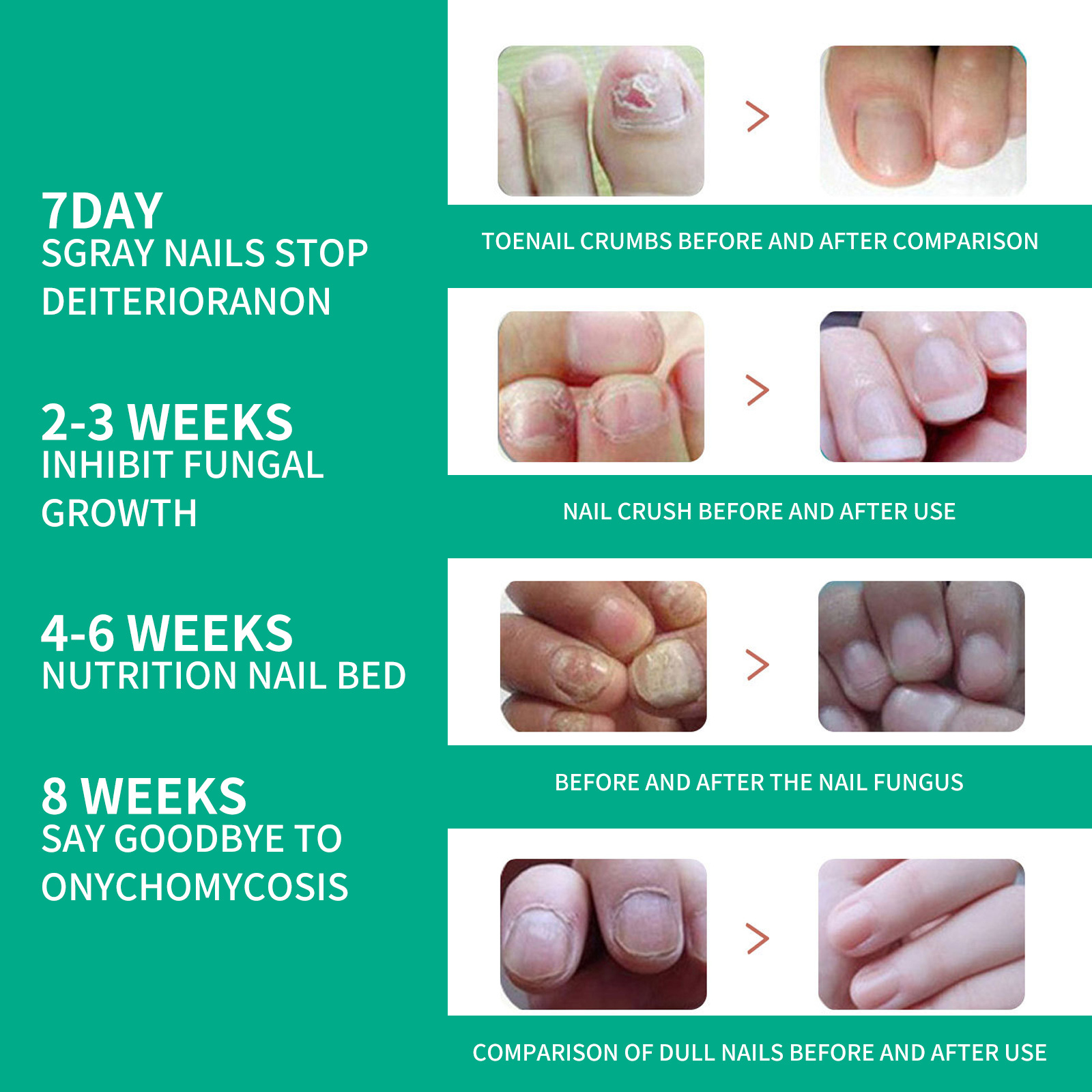 Teal nail care timeline with illustrative comparison panels