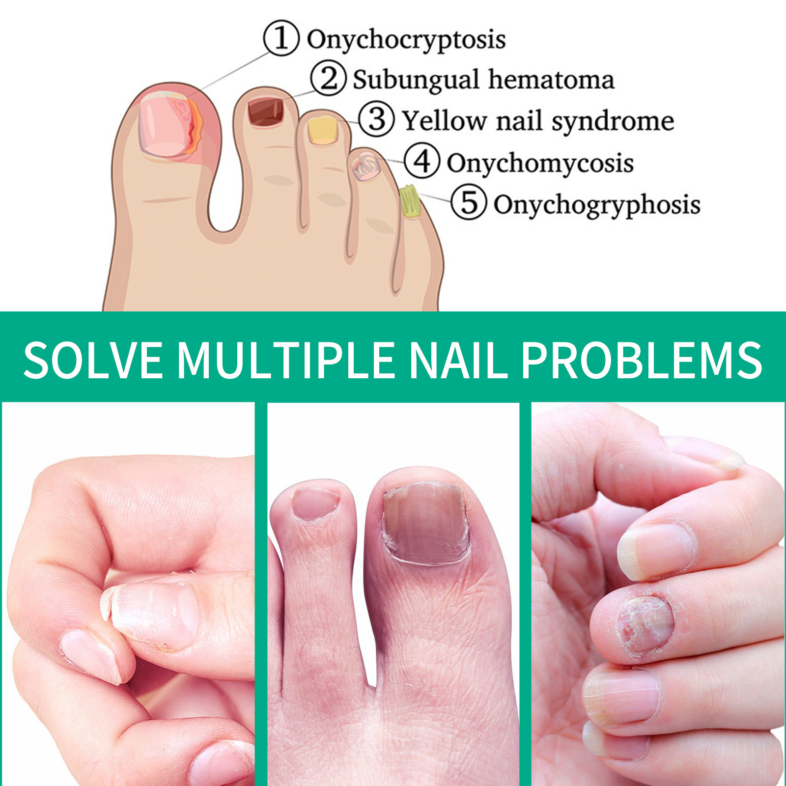 Nail condition guide beside targeted care product