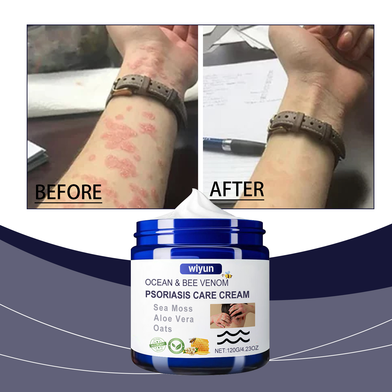 Cream jar beside a visible before-and-after skin comparison