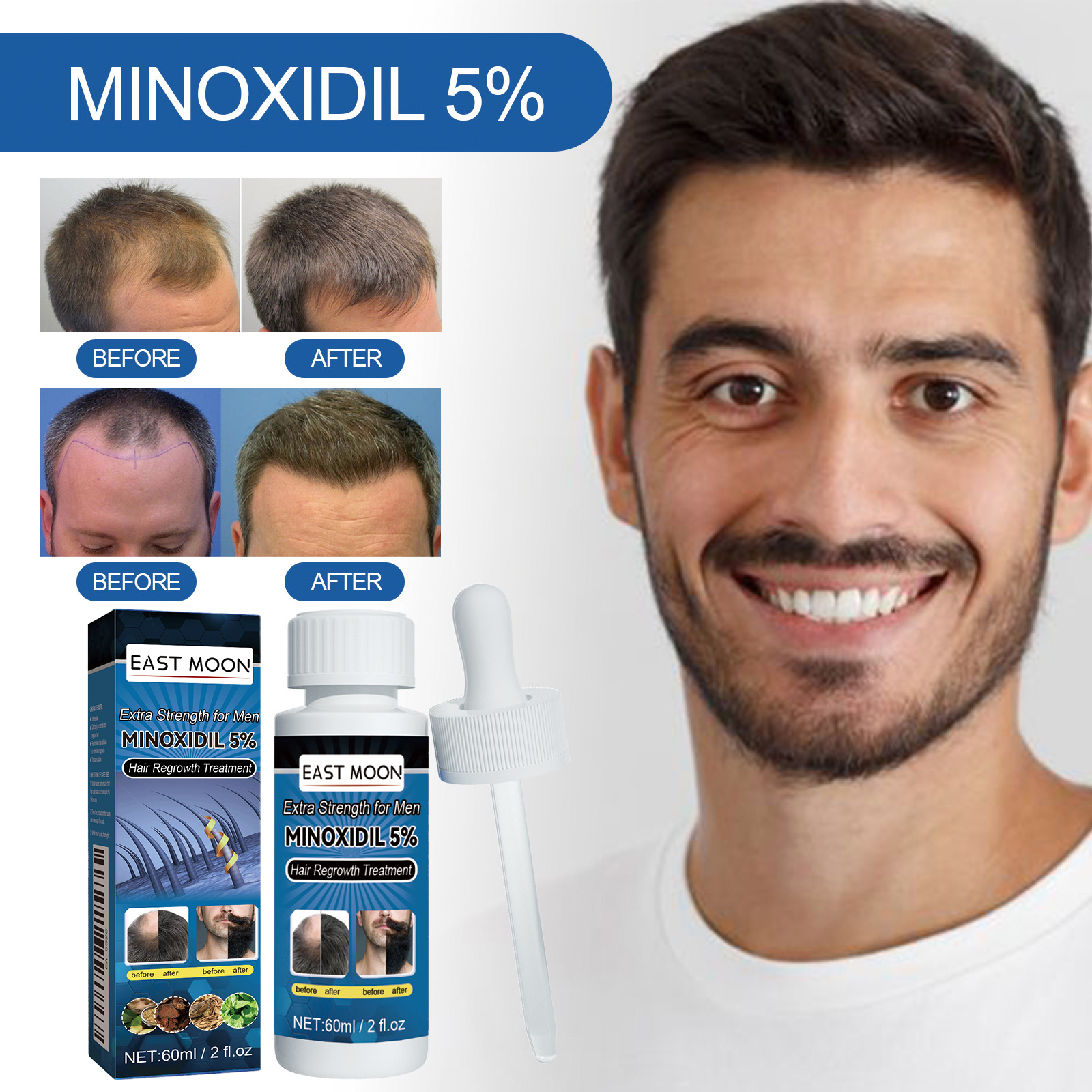 Man checking thinning hairline in promotional treatment image