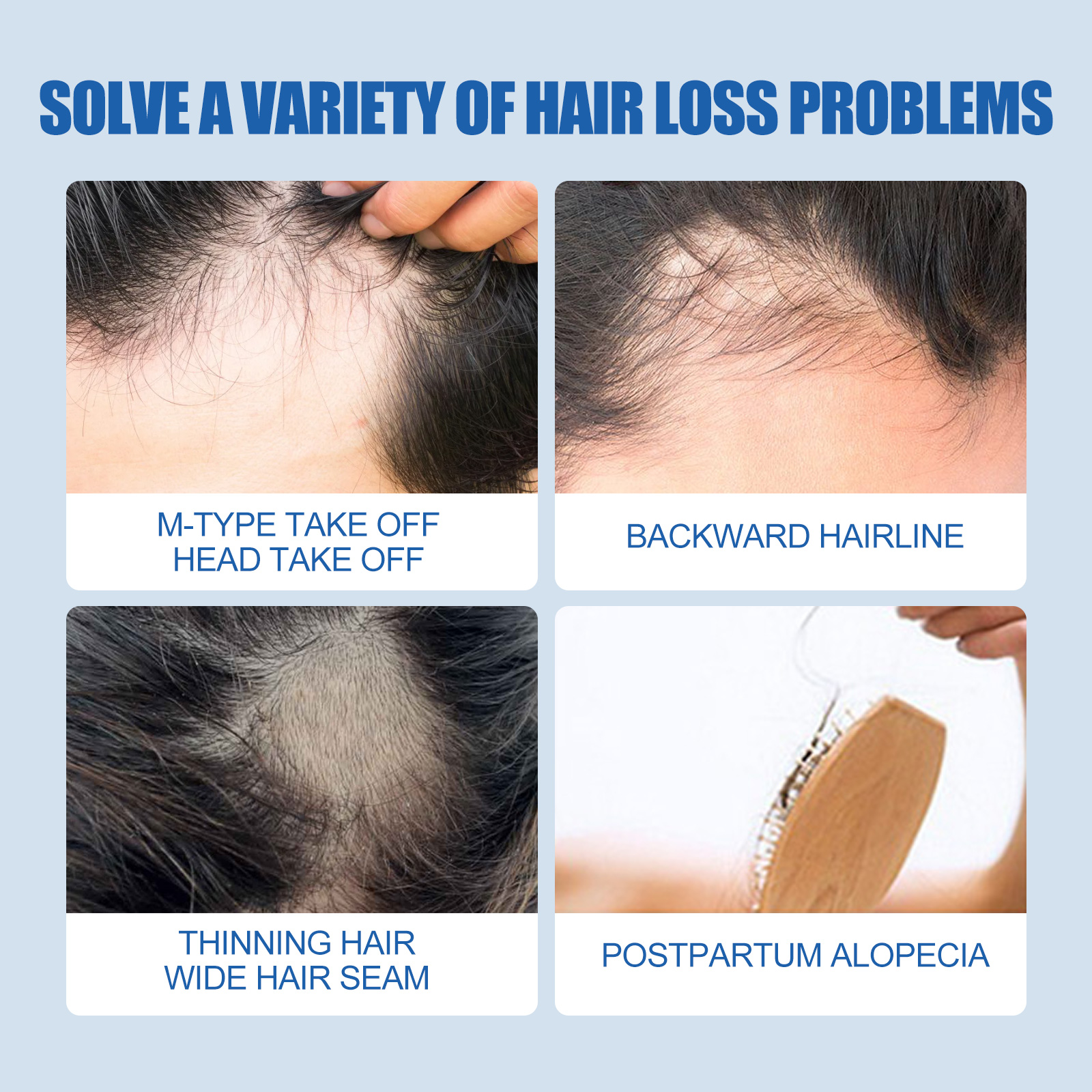 Graphic showing hairline and thinning concerns